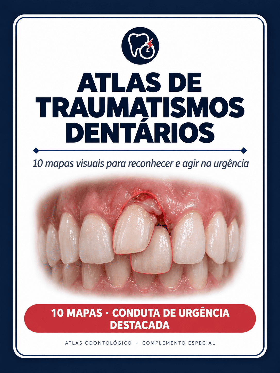 Atlas de Traumatismos Dentários