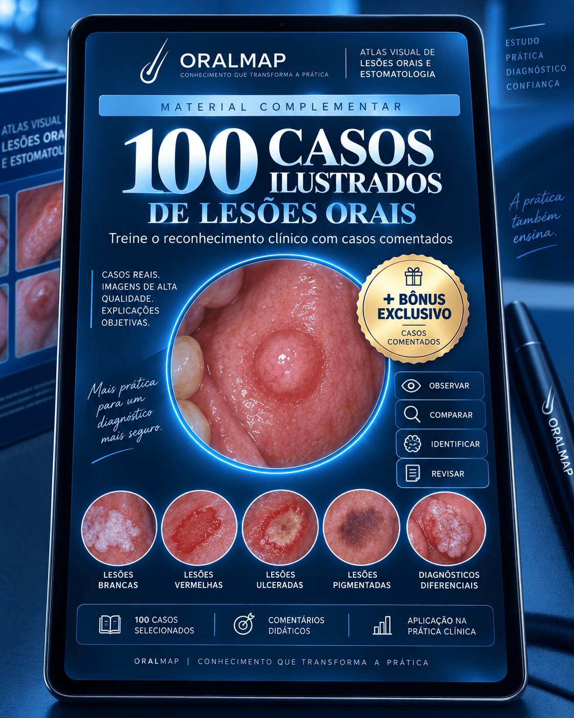 100 Casos Ilustrados de Lesões Orais