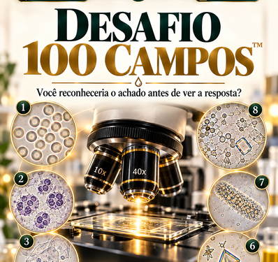 Desafio 100 Campos