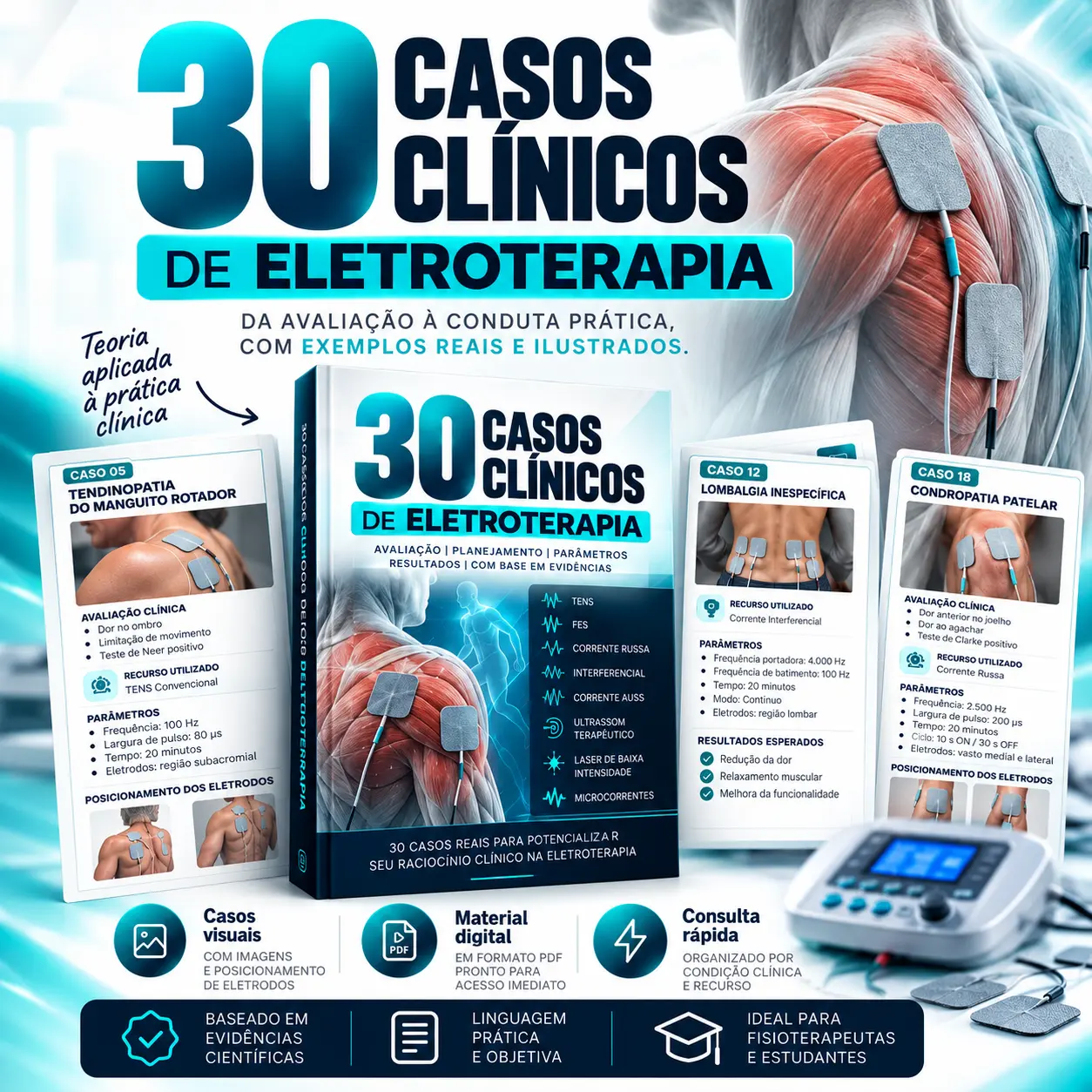 30 Casos Clínicos de Eletroterapia