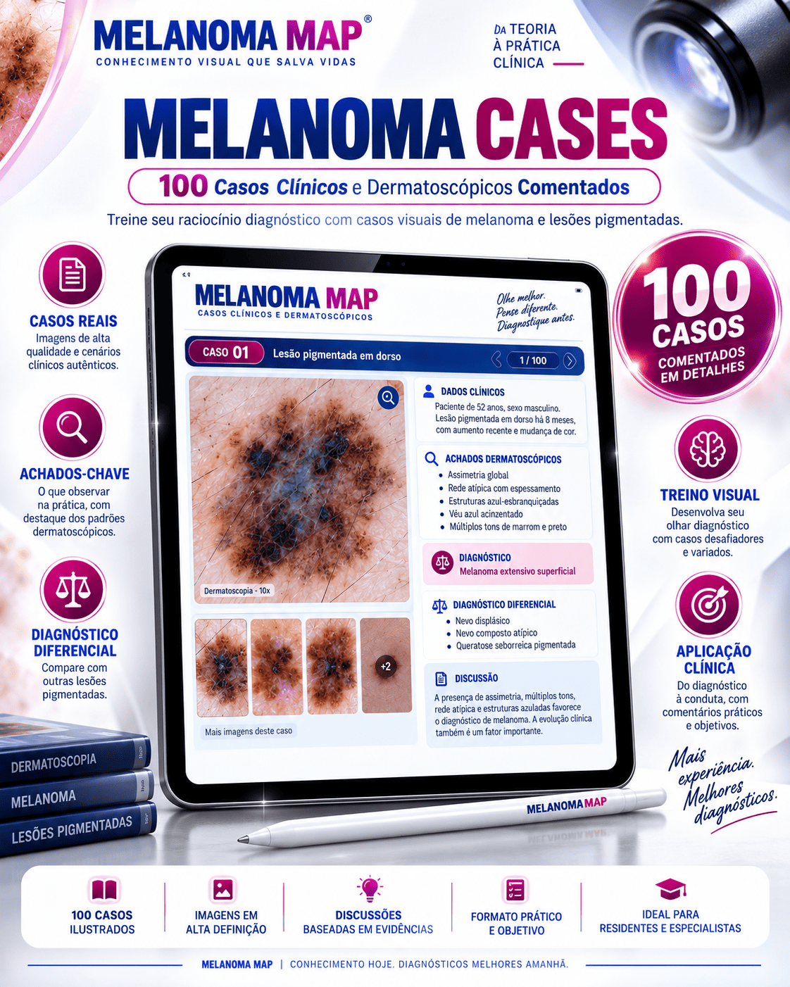 Casos Clínicos e Dermatoscópicos