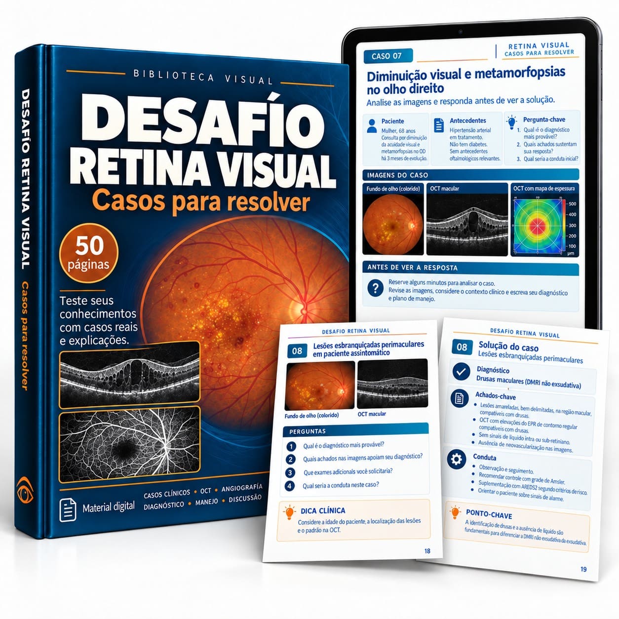Desafio Retina Visual — Casos p resolver