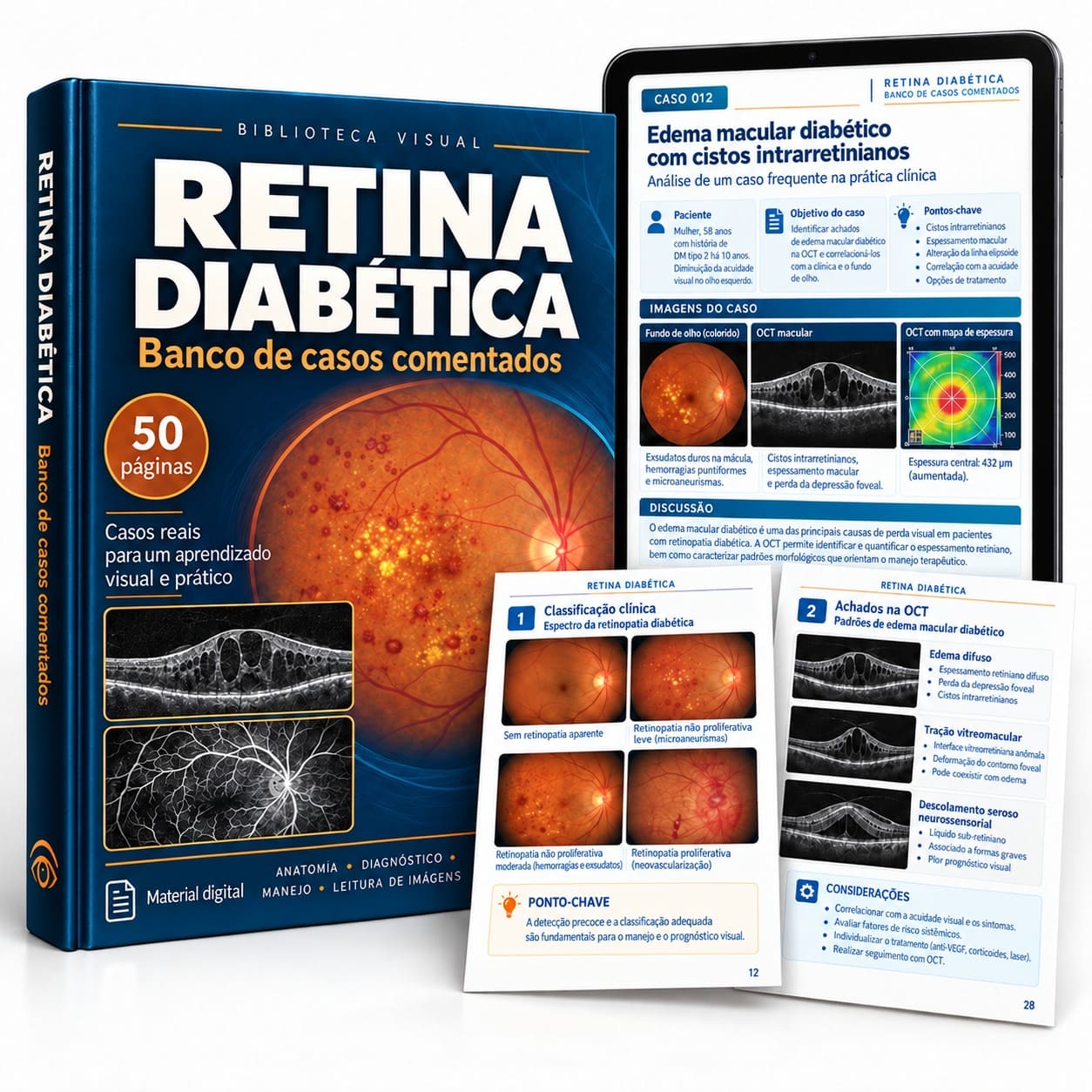 Retina Diabética — Casos Comentados