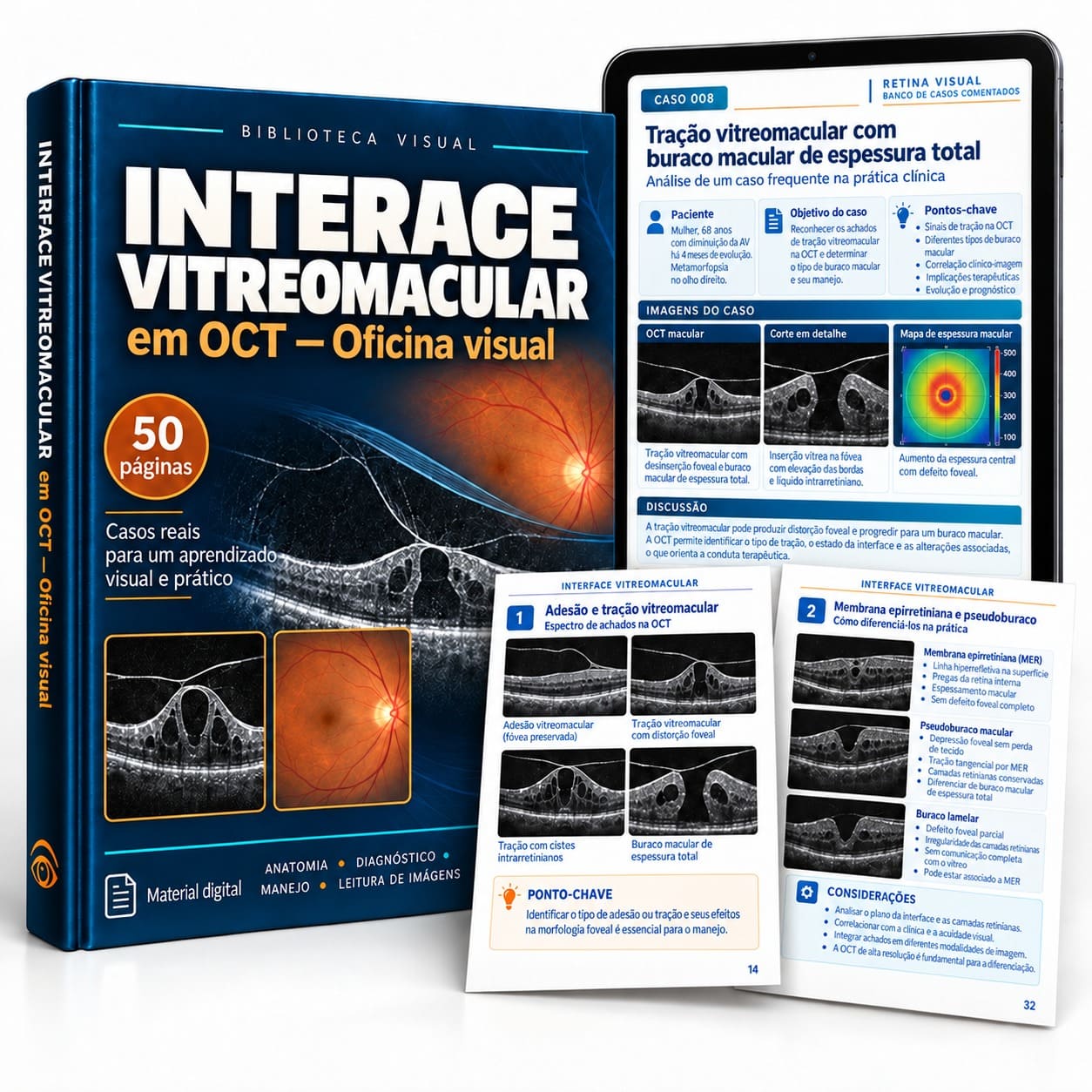 Interface Vitreomacular no OCT — Oficina