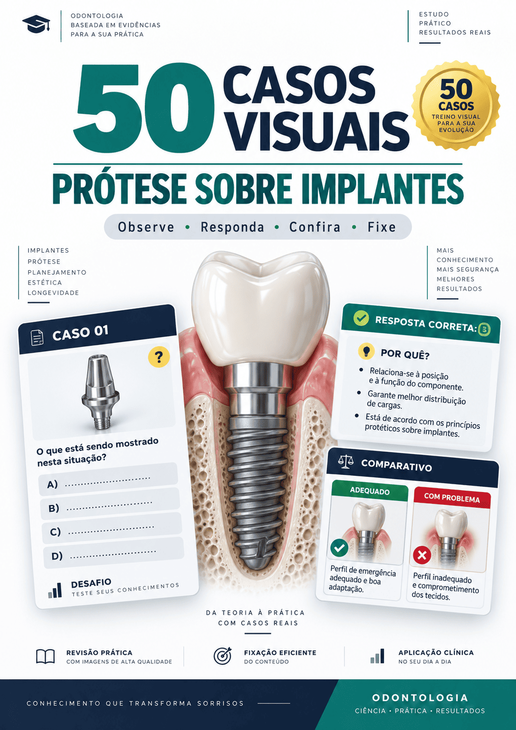 50 Casos Visuais Prótese sobre Implantes