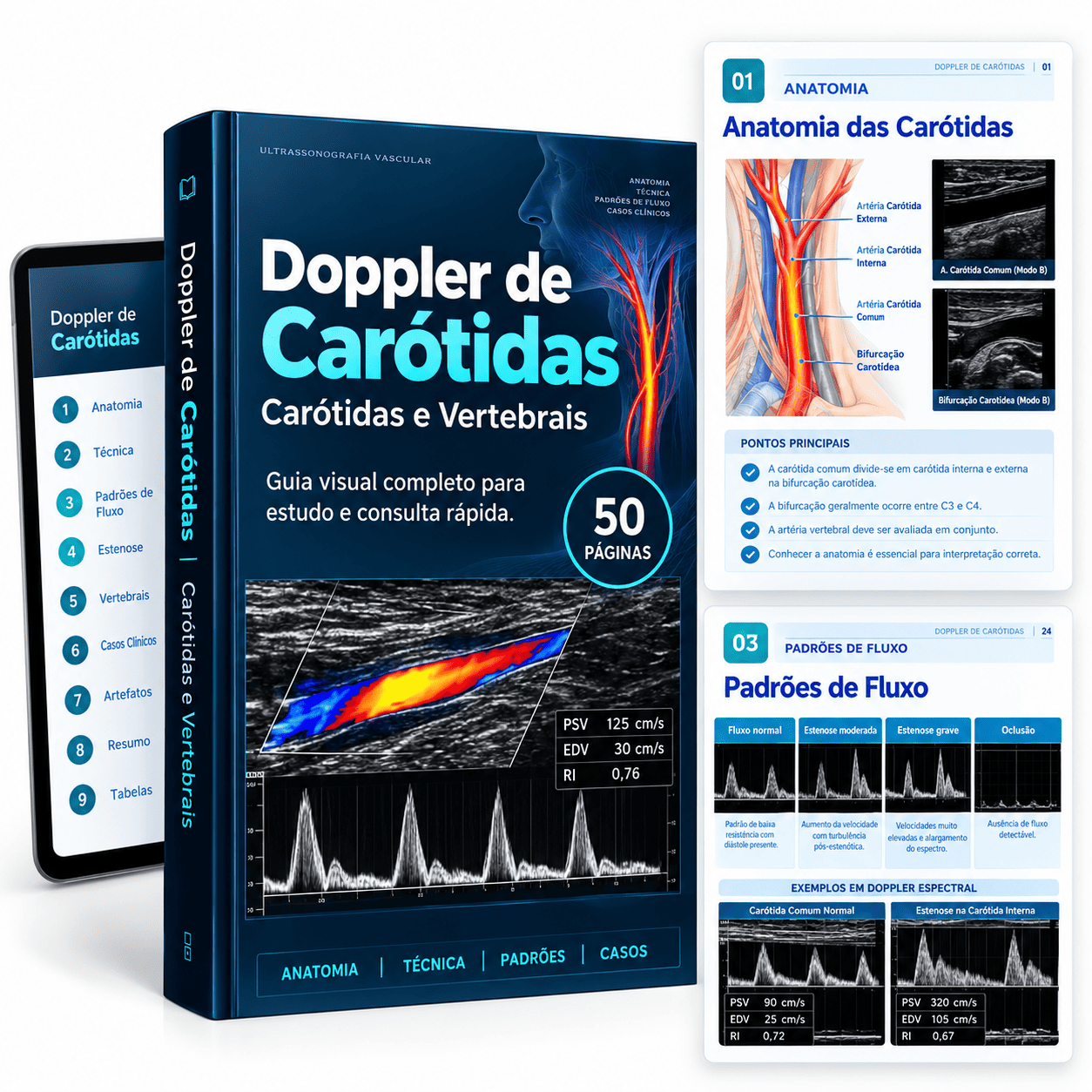 Doppler de Carótidas e Vertebrais