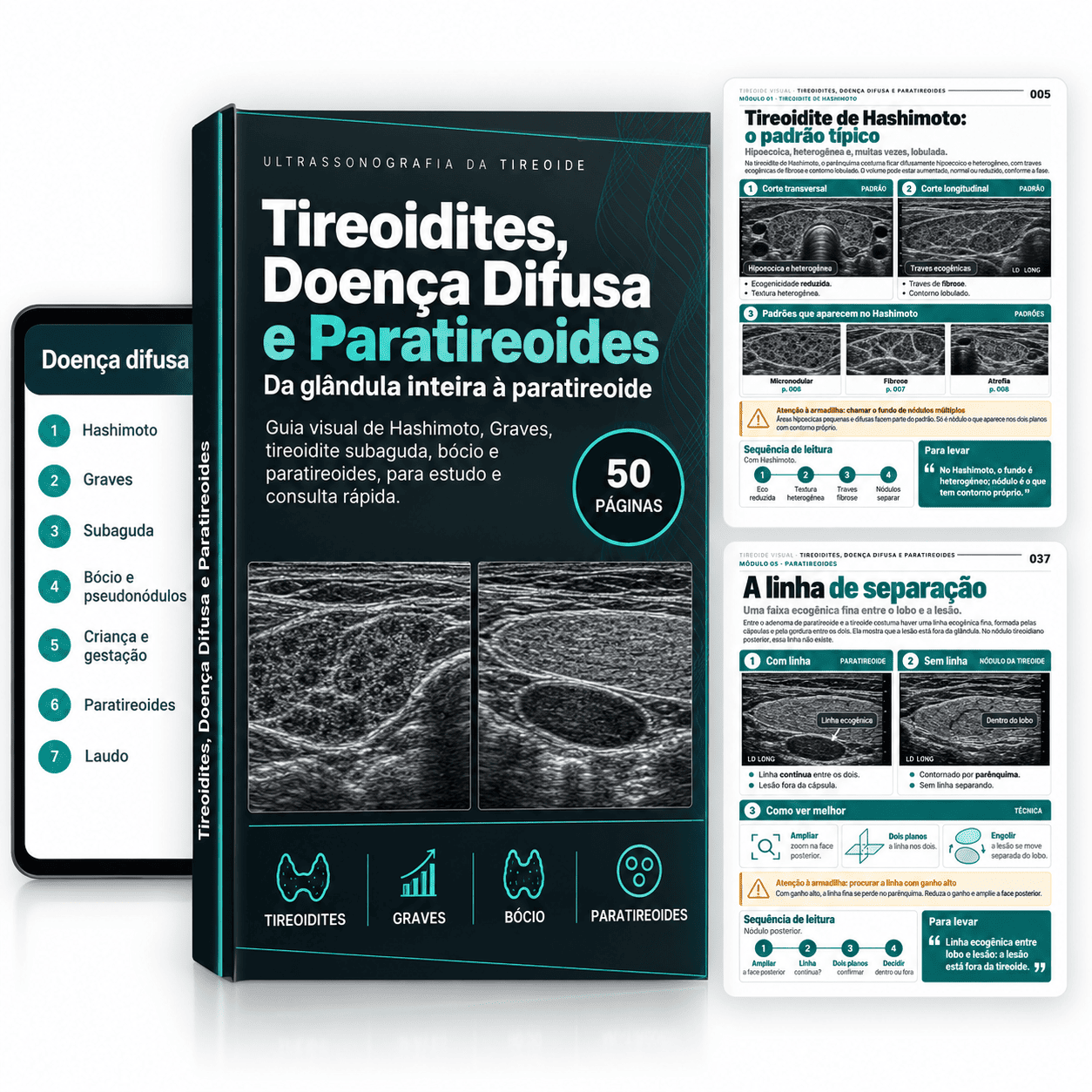 Tireoidites, Doença Difusa e Paratireoid
