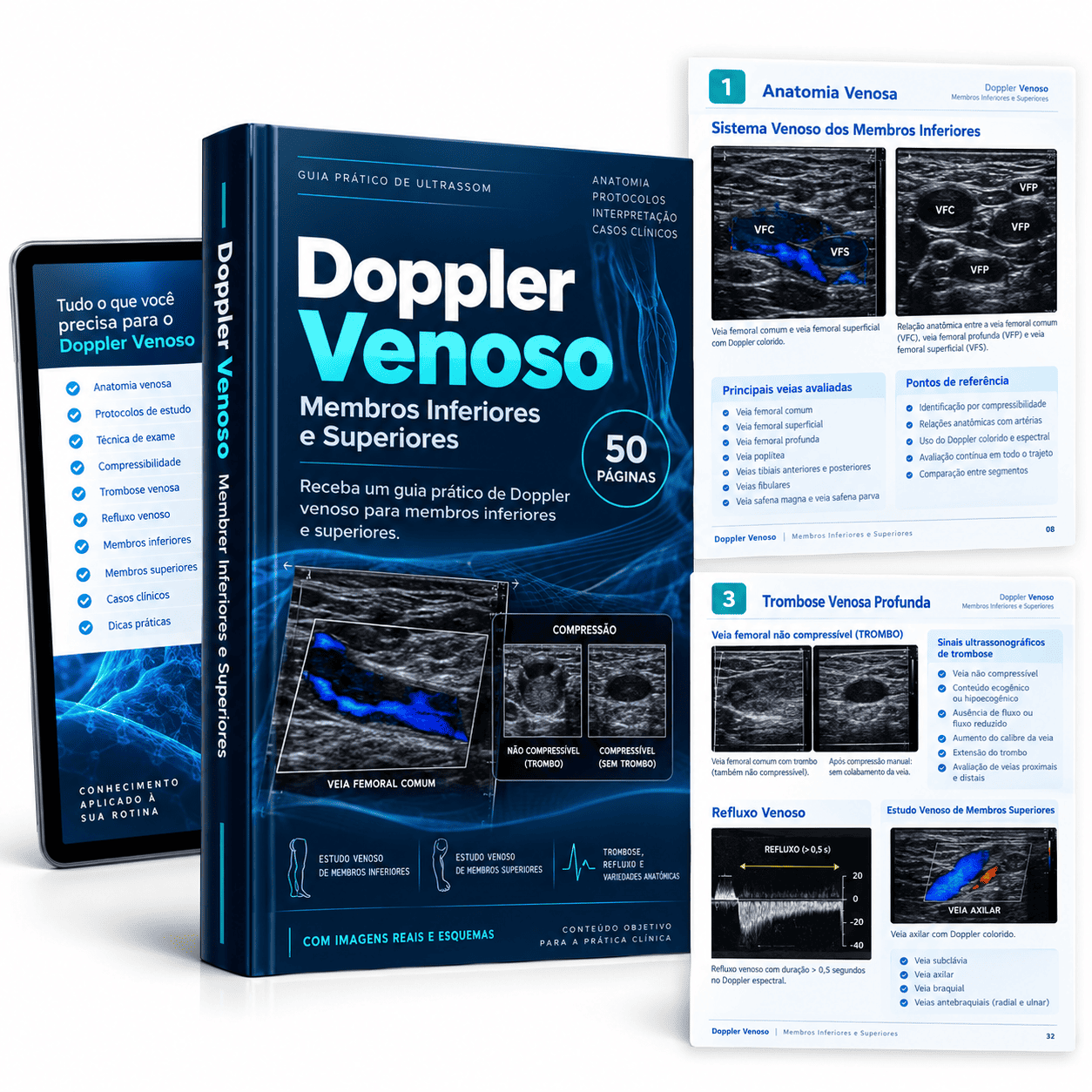 Doppler Venoso — Inferiores e Superiores