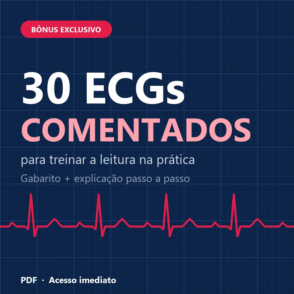 Sim, quero treinar com 30 ECGs comentado